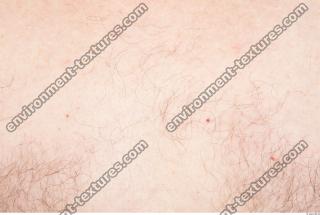 photo texture of hairy skin 0005